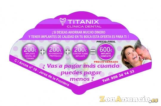 IMPLANTES DENTALES BARATOS EN JEREZ